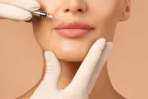 Close up of woman's lips getting dermal filler injections in Calgary, AB